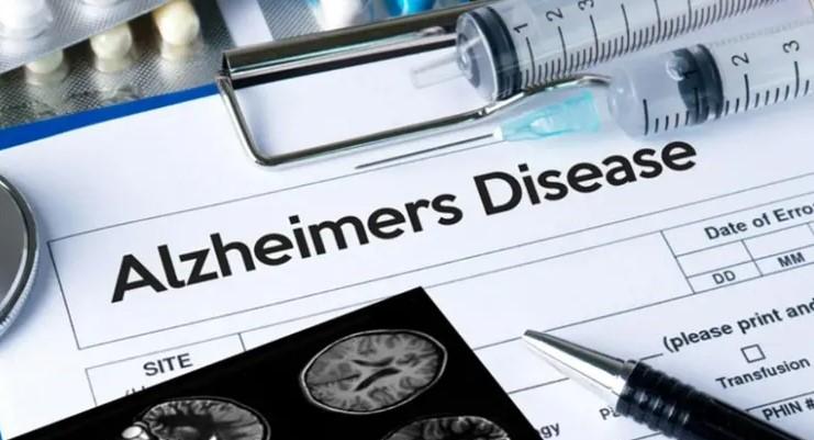 Lanzan al mercado la primera prueba de Alzheimer